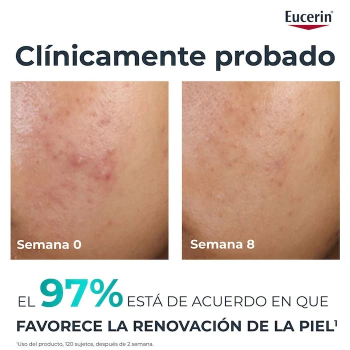 EUCERIN DERMOPURE PEELING 10 40ML
